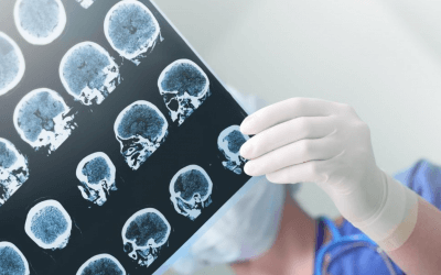 This Jax company is accelerating the path to treat Parkinson’s